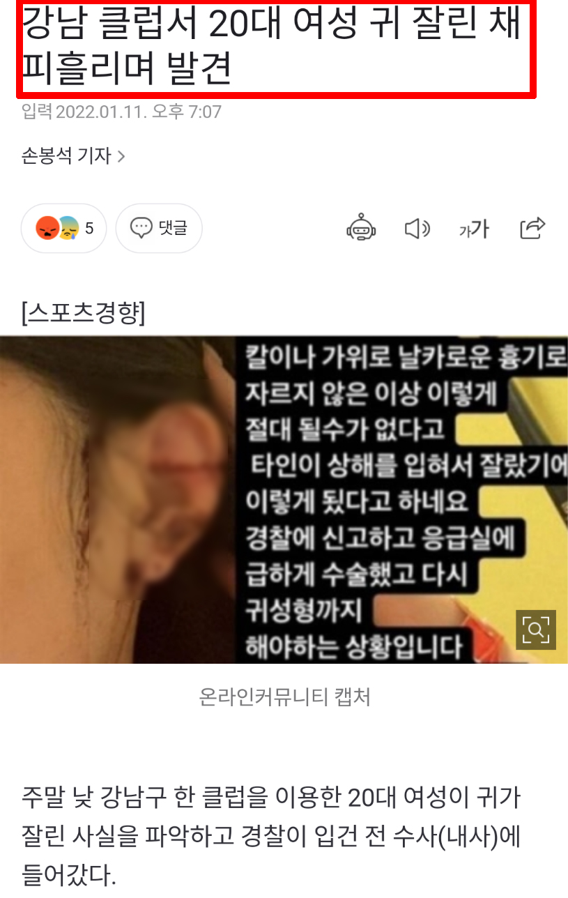 강남 클럽 귀 절단 사건