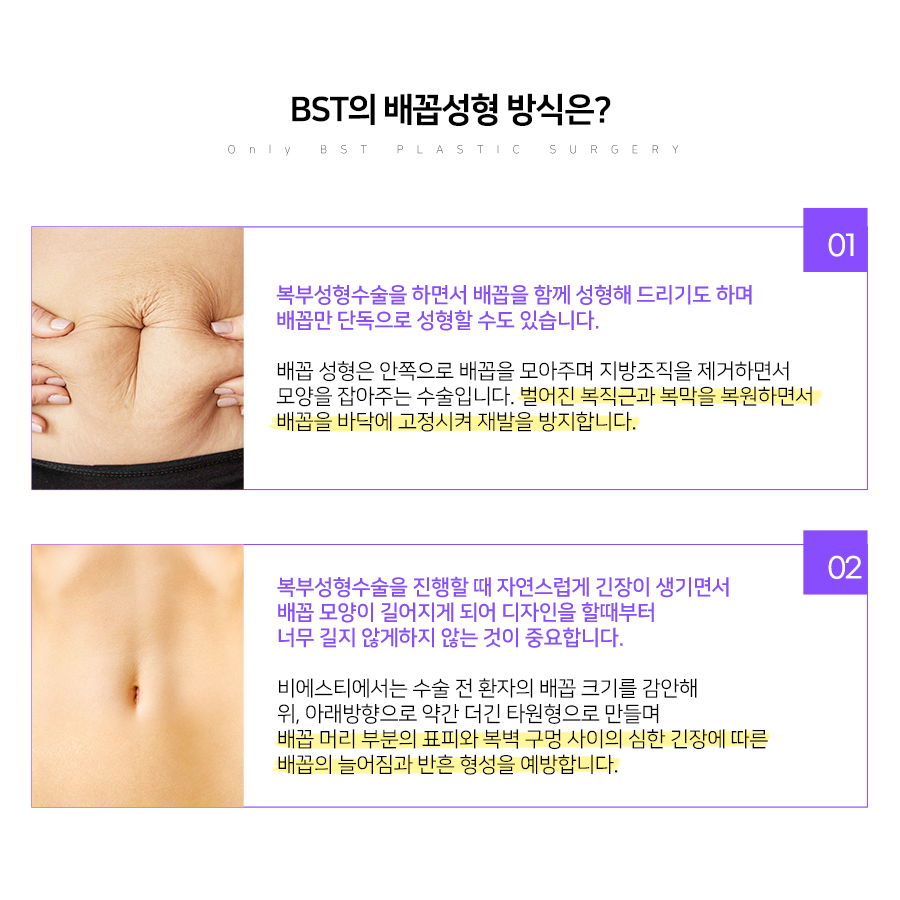 BST의 배꼽성형 방식은? 
1. 복부성형수술을 하면서 배꼽을 함께 성형해드리기도 하며 배꼽만 단독으로 성형할 수도 있습니다. 
2. 복부성형수술을 진행할때 자연스럽게 긴장이 생기면서 배꼽 모양이 길어지게 되어 디자인을 할때부터 너무 길지 않게 하지 않는 것이 중요합니다.