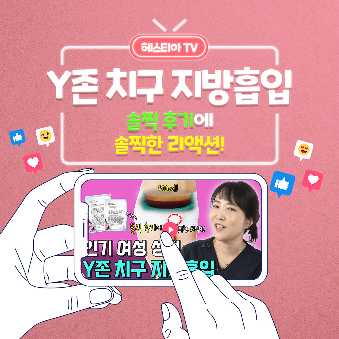 치구지방흡입
Y존