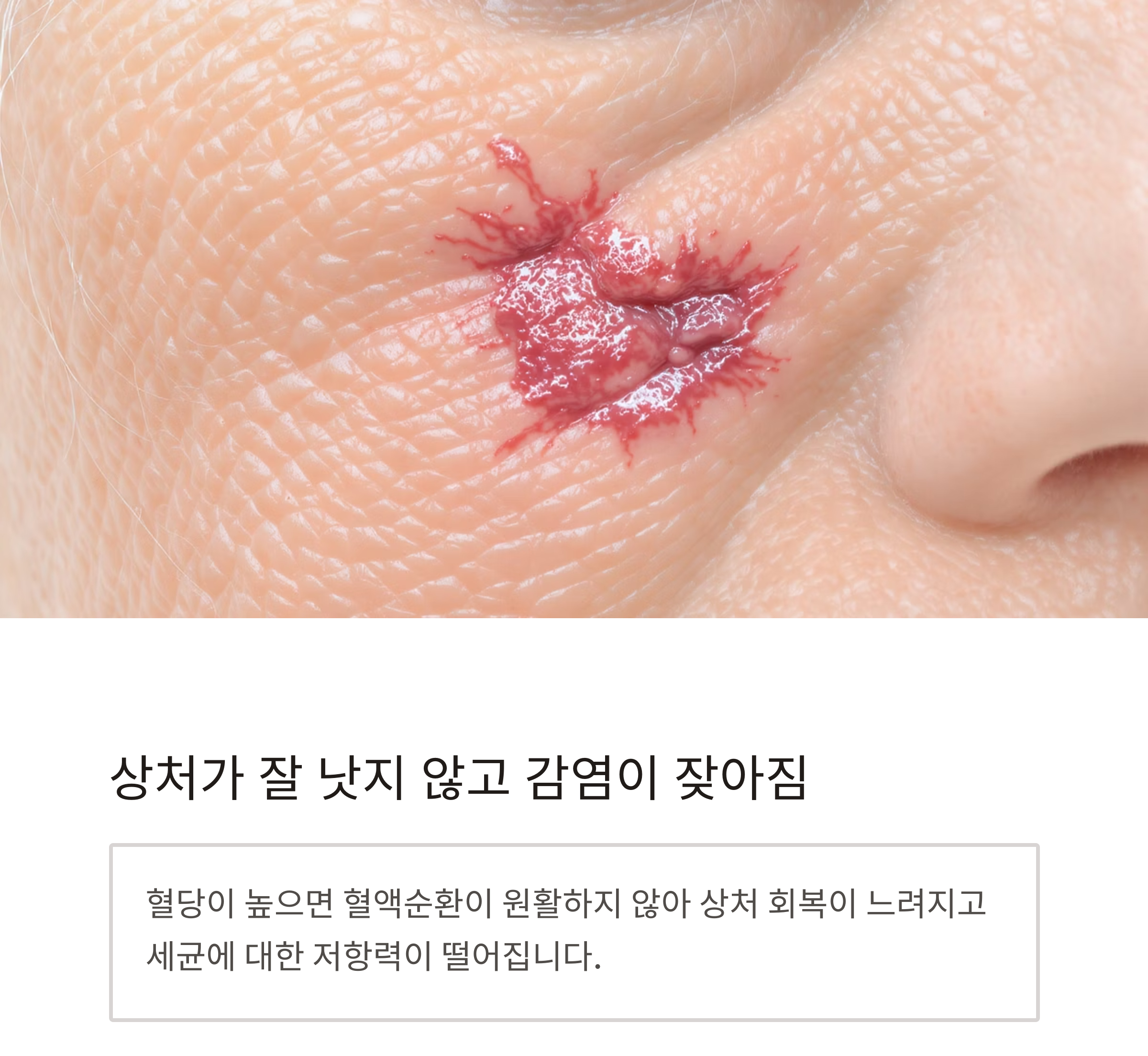 혹시 나도 당뇨? 시니어가 꼭 알아야 할 당뇨병 초기 증상