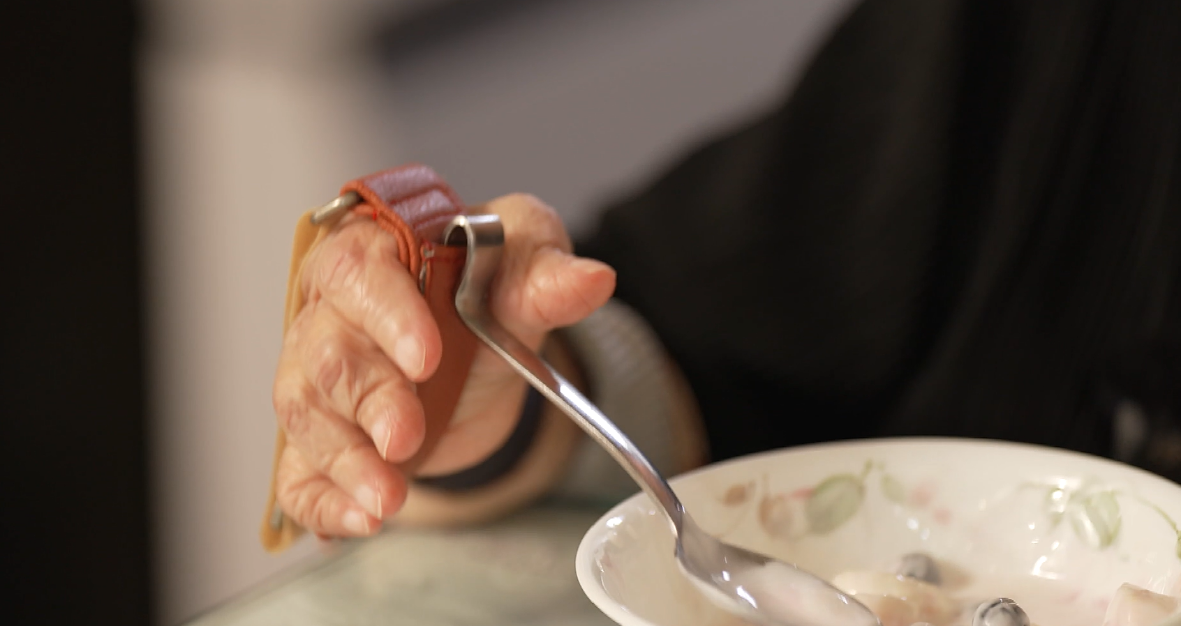 명의 류마티스 관절염