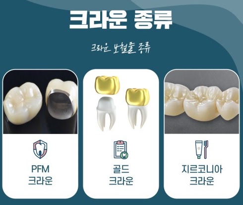 보철물 종류