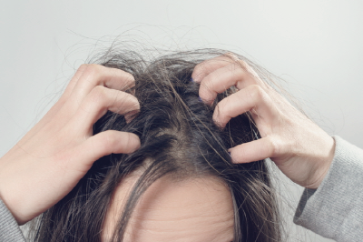 머리 가려움증의 원인