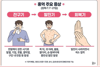 홍역증상