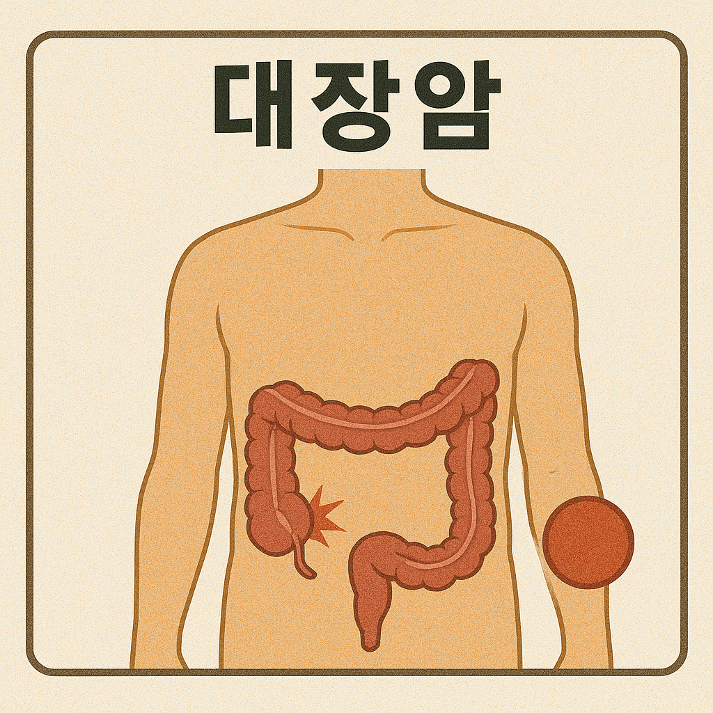 대장암 검진 시기와 예방법