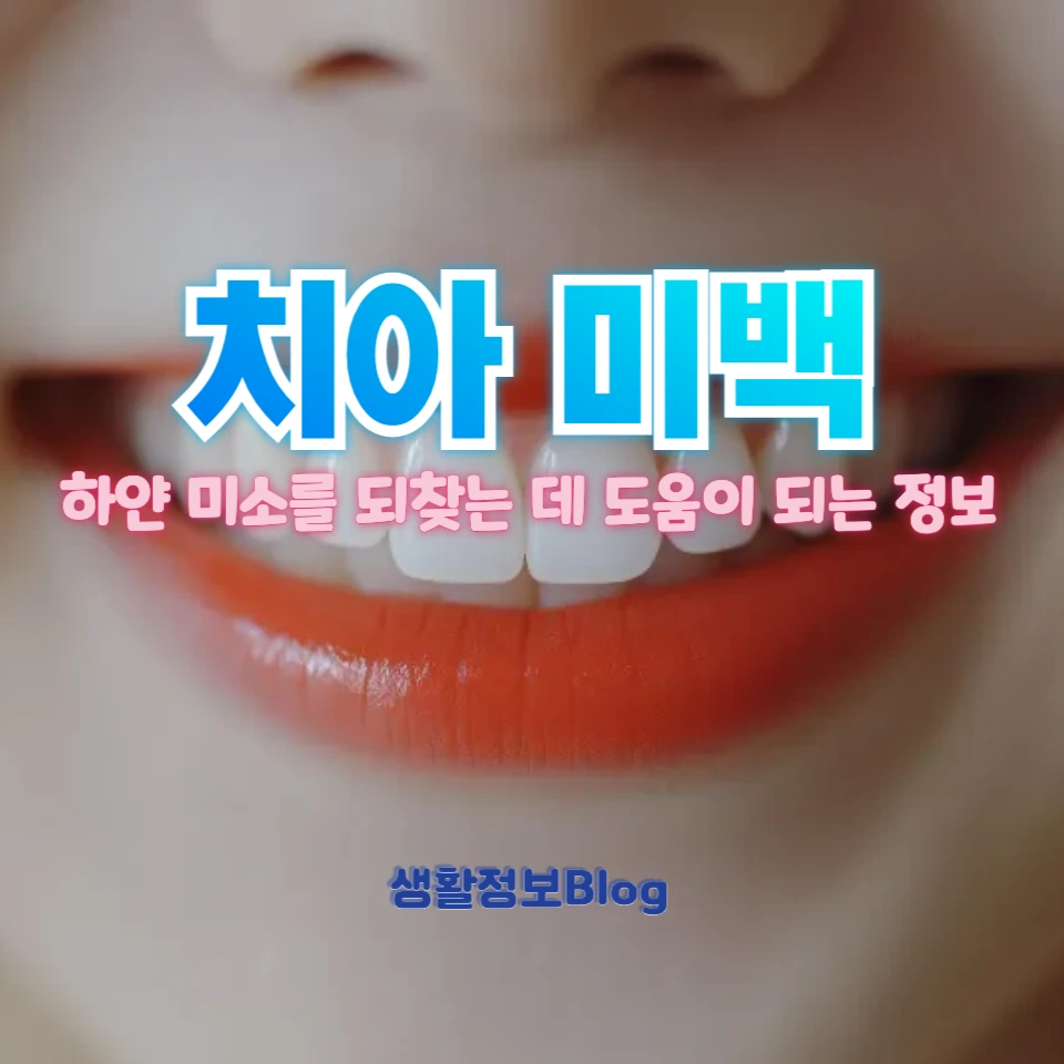 치아 미백 방법