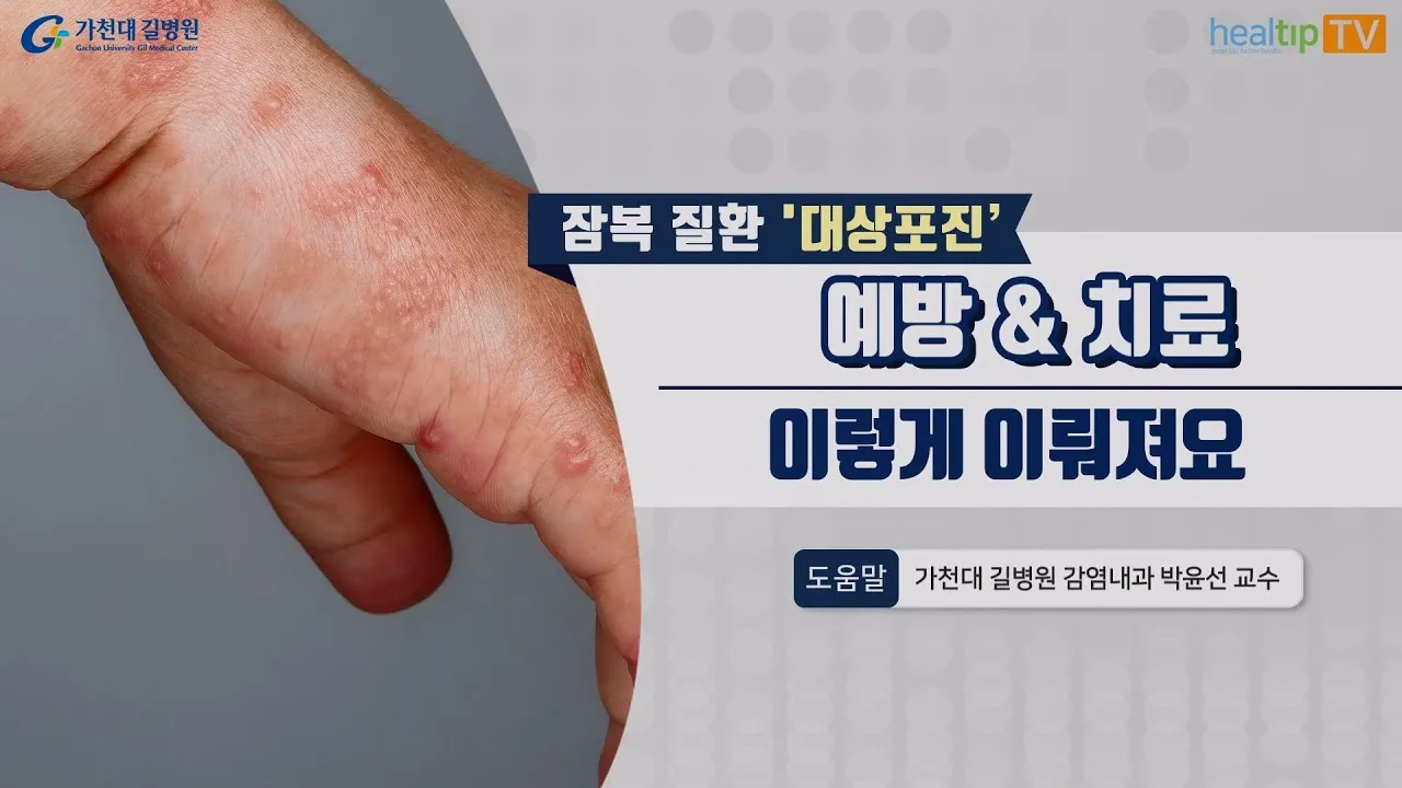 대상포진 치료방법에 대한 총정리 건강 질병관리_8