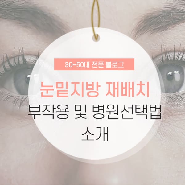 눈밑지방 재배치 부작용 눈밑지방 재배치 부작용 및 수술 시간 소개
