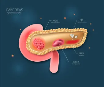 강아지 췌장암 증상 진단 치료법 안내_6