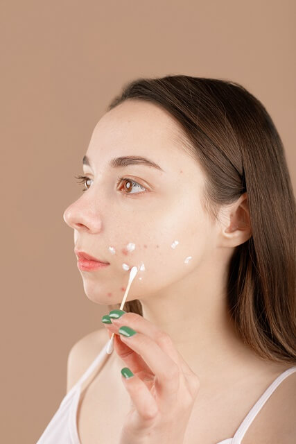 생리 기간 피부 관리 방법