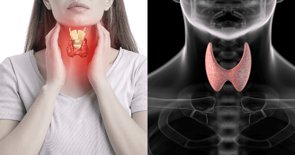 갑상선이 있는 목을 부여잡는 여성과 갑상선이 표시된 엑스레이