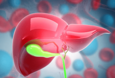 담낭염의 증상, 담낭 용종