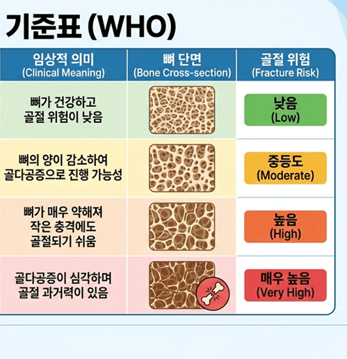 골다공증 수치보는법