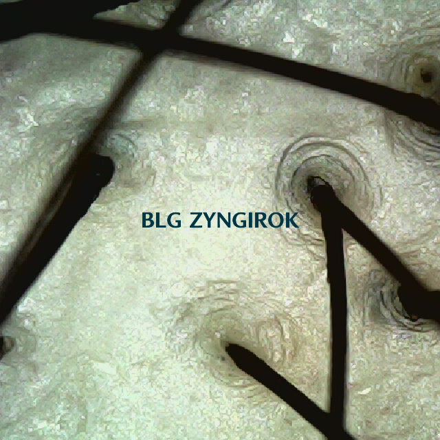 정수리 모공 모습이다.