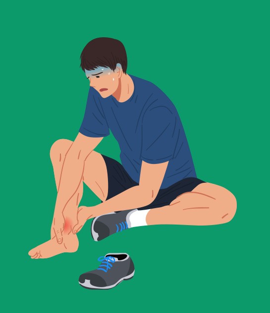 통풍 초기증상 발통증 사진