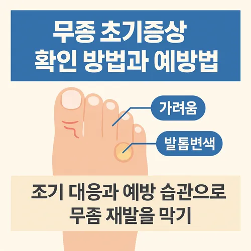무좀 초기증상 확인 방법과 예방법 썸네일