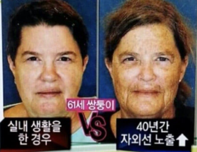 선크림의 중요성