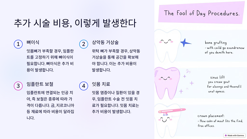 임플란트 가격