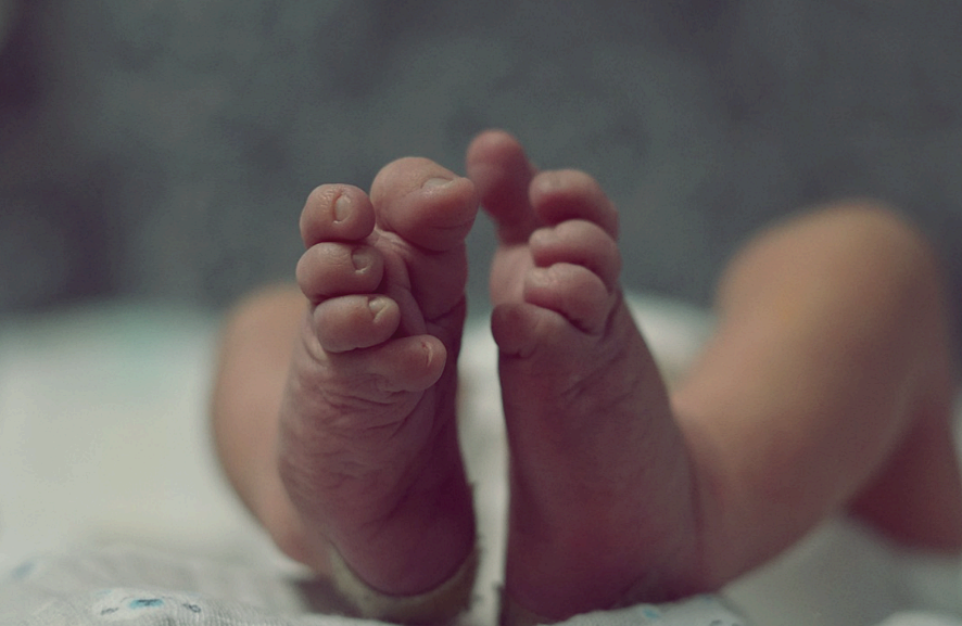 골덴하 증후군, 신생아 25,000명 중 1명에게 발생하는 선천적 기형 희귀 질환