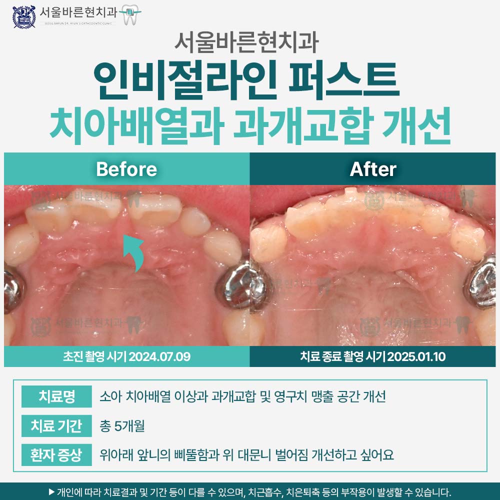 해운대인비절라인퍼스트