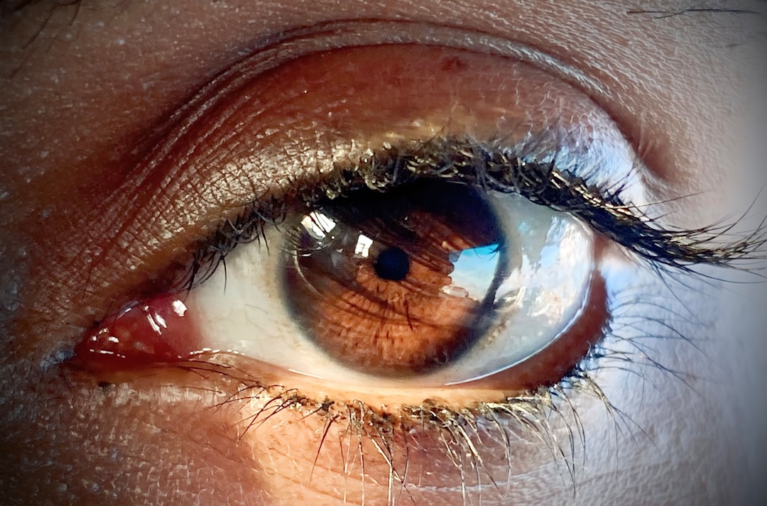 Cataract