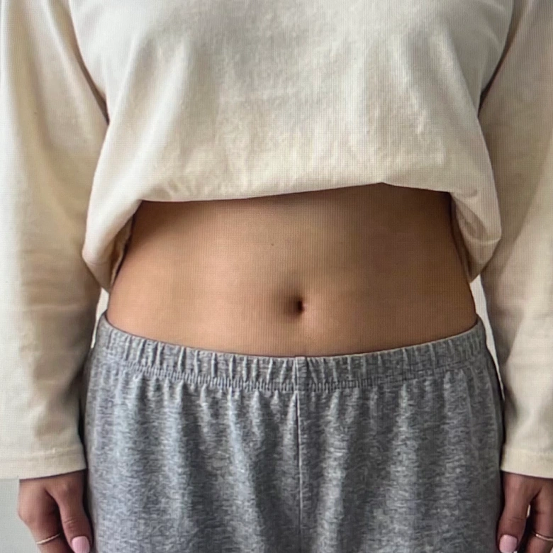 푸응 팻버닝 다이어트 후기 증명하기 위한 뱃살 사진