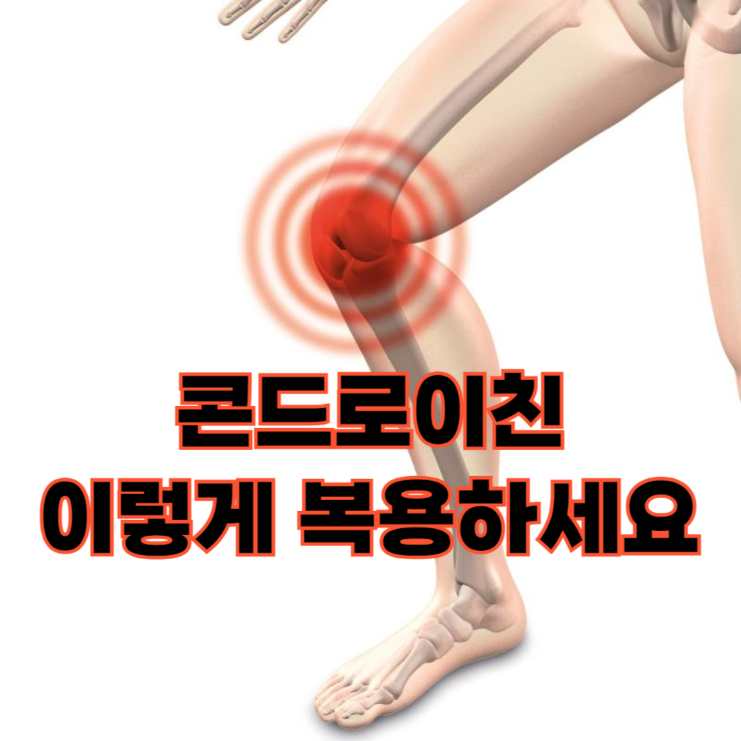 콘드로이친 관련 관절염 이미지