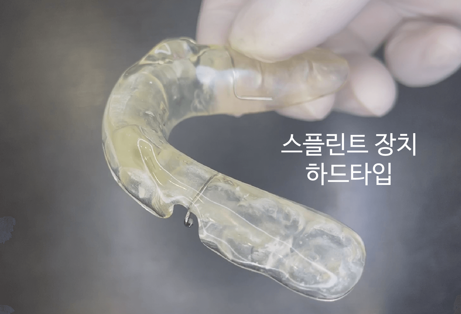 이갈이-장치