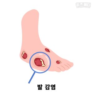 맨발 걷기 효능 부작용