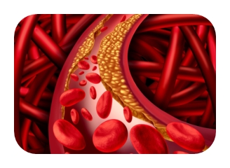콜레스테롤 이미지