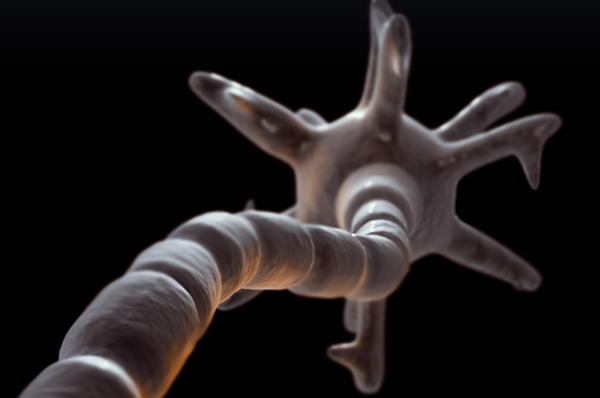 다발성 경화증 관련사진