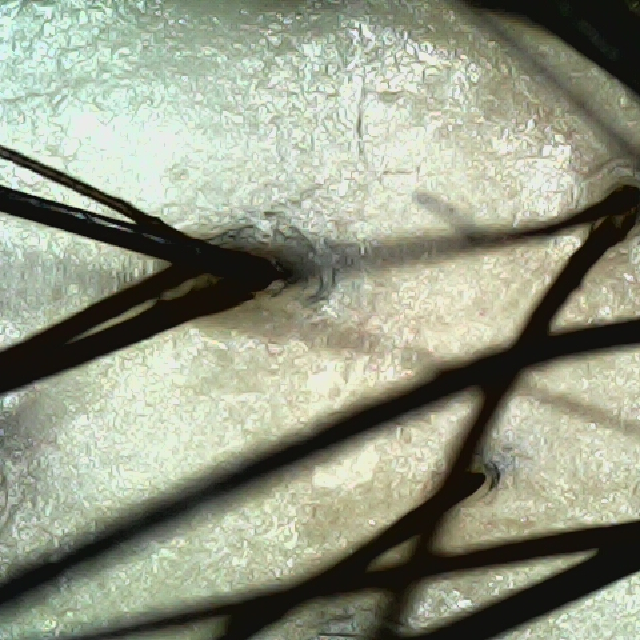 탈모 극복 프로젝트 - 정수리 두피 모습이다.