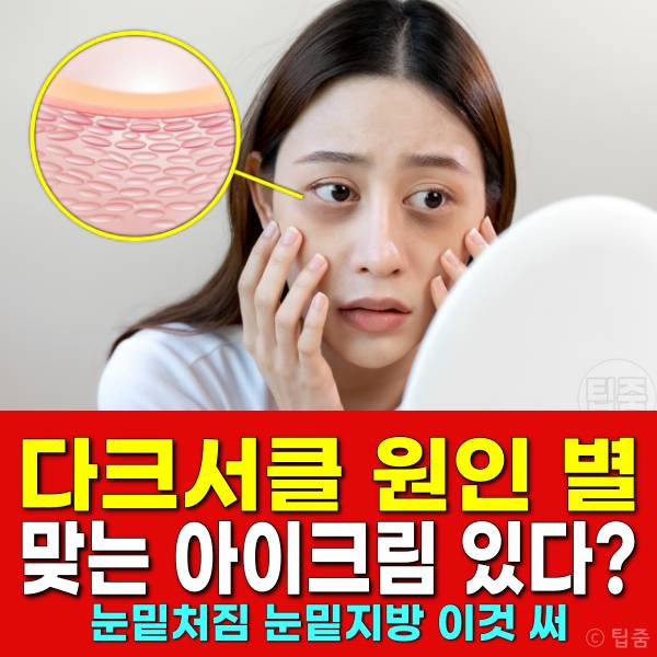 다크서클 원인 아이크림 추천 눈밑처짐 눈밑지방