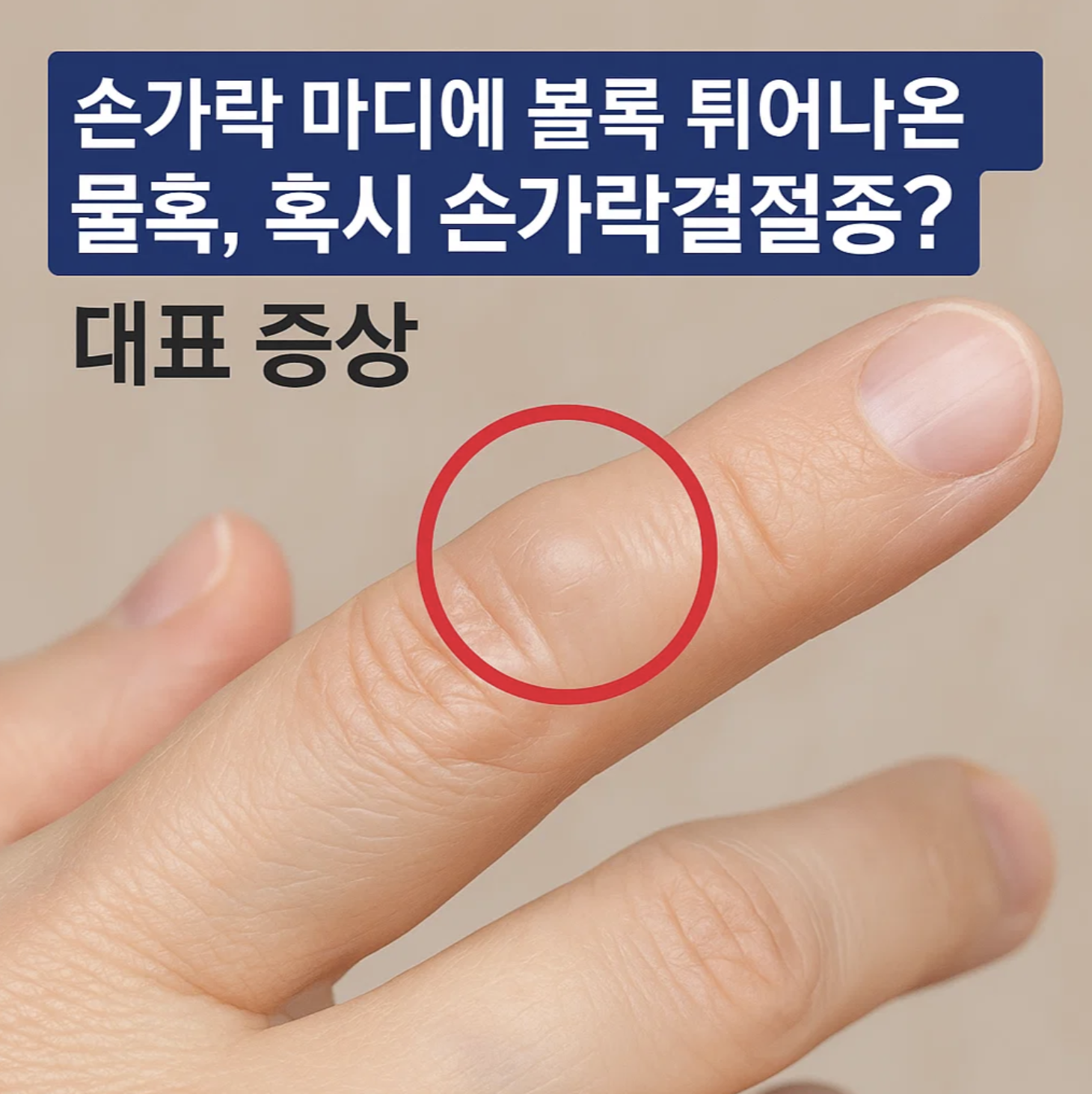 손가락 마디에 볼록 튀어나온 물혹, 혹시 손가락결절종? 대표 증상