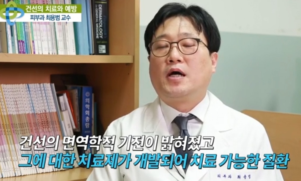 EBS명의-피부-명의-최용범-교수