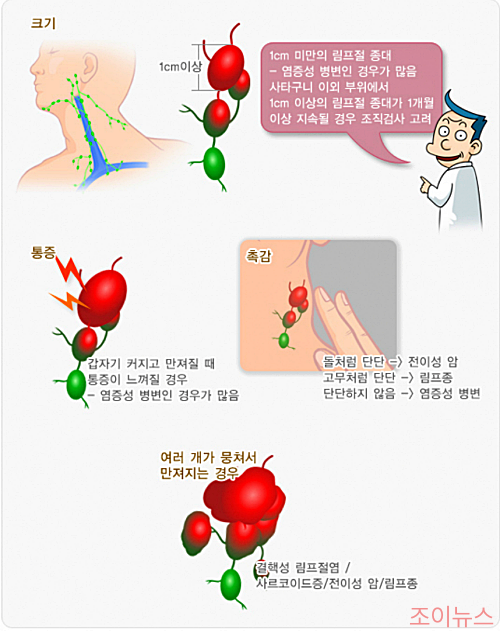 목 부음과 림프절염의 증상_이미지출처: 국가건강정보포털