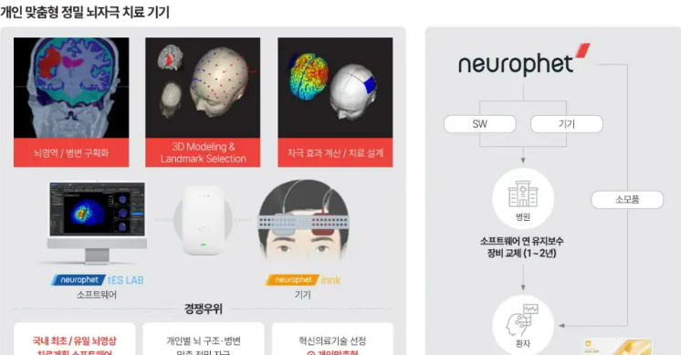 뇌질환 AI 기업 뉴로핏 공모가 상단 확정! 투자 기회일까?