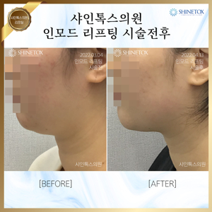 부산인모드