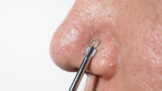 효과적인 코피지 제거 방법