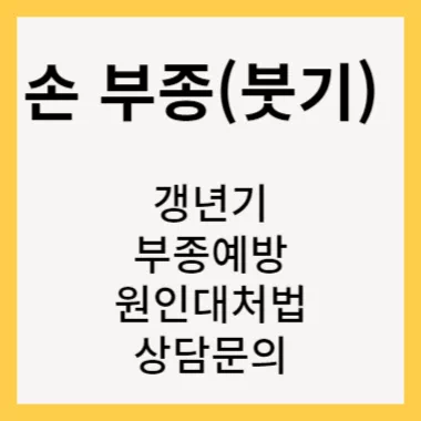 손 부종 (붓기) 원인과 대처 산담문의 썸네일