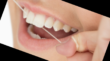 잇몸 내려앉음 치료