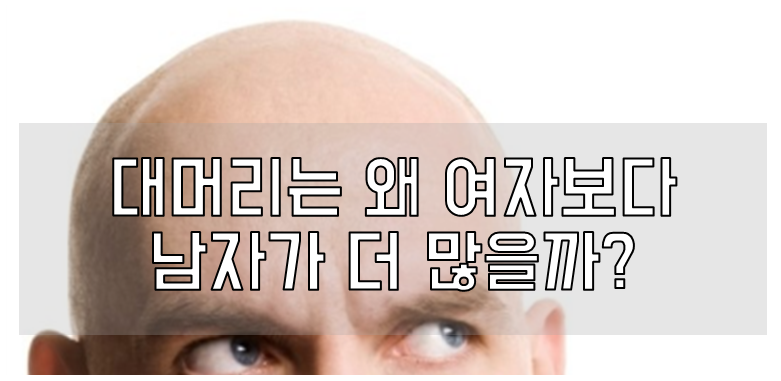 대머리 이유