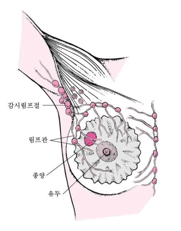 유방의 림프 전의
