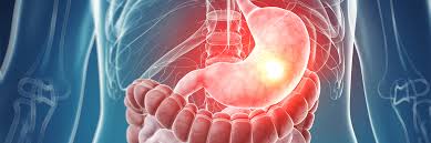 위 내시경 금식시간 위 내시경 전날 음식, 음식 체크, 주의사항