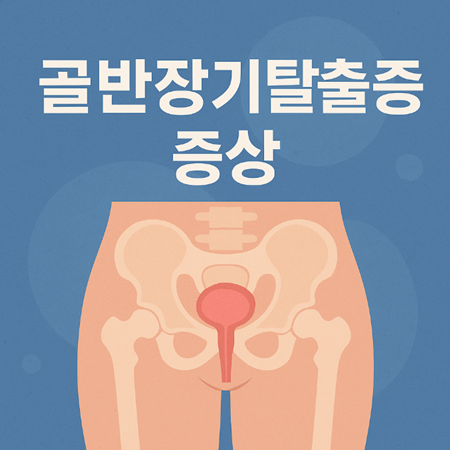 포스팅 썸네일 사진