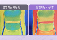EMS와 온열 기능의 원리