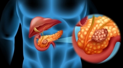 췌장에좋은음식이미지