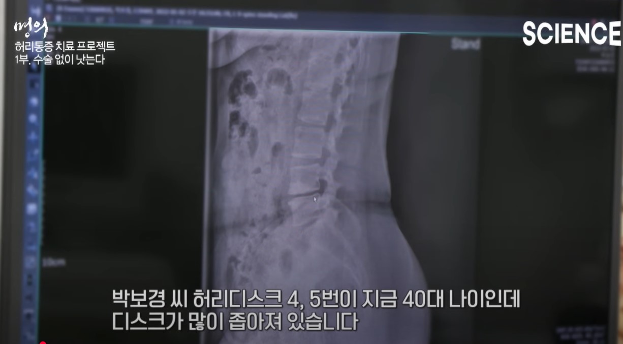 환자의 허리디스크 상태 확인하는 정선근 교수