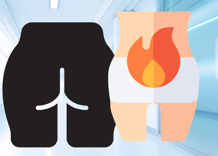 엉덩이-항문-통증-그림