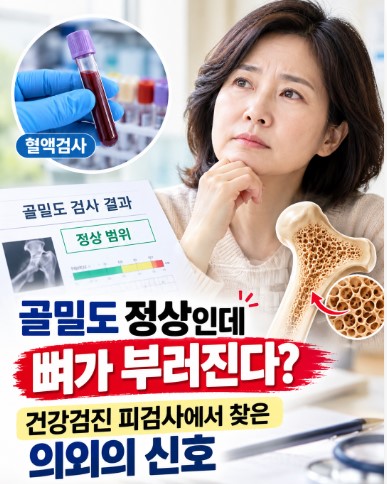 골밀도